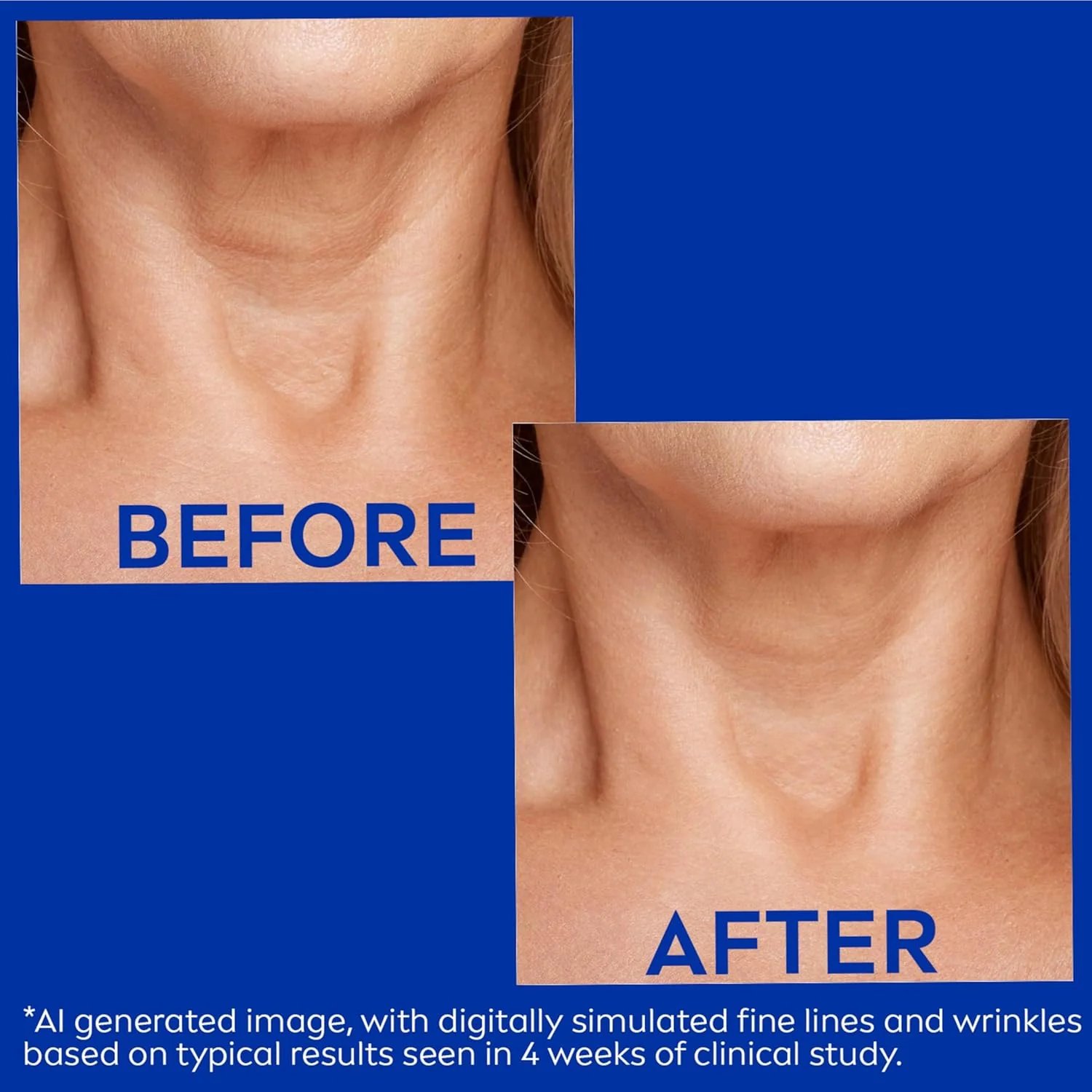 OEOMON™ Collagen Fullerene Neck Cream – Elevate Your Neck Care Routine ✨